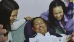 Primeras fotos de Hugo Chávez