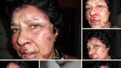 CVP lunes 16 de septiembre del 2013 con actriz Ana Luisa Rubio.