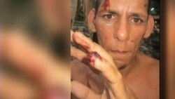 Publican informe de derechos humanos en Cuba