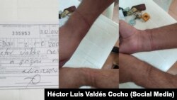 Marcas que le dejaron las esposas al periodista independiente Héctor Luis Valdés Cocho 