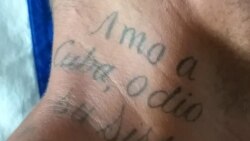 Amenazan a activista de FANTU para que se quite un tatuaje