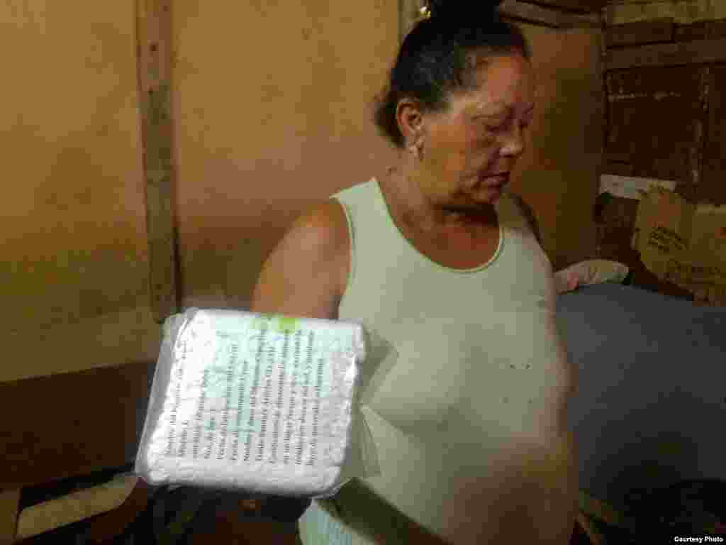 La madre de Yeison Olivera Pérez muestra un paquete de pañales que no le sirven al niño. Fotos: Pastor Alejandro Hernández.