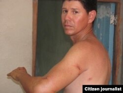 El reportero independiente Yoel Bencomo fue agredido a cuchilladas.