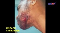 Rapero es golpeado por cantar contra el régimen cubano