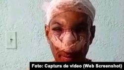 Golpean brutalmente en La Habana a Pablo Morales Marchán, coordinador Nacional de Prensa del Partido Unión por una Cuba Libre