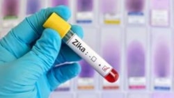 1er caso de zika autóctono en Cienfuegos