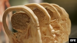  Imagen de las secciones transversales de un cráneo y cerébro humano.