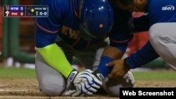 Céspedes recibió un pelotazo en la mano izquierda.