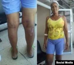 La presa política Xiomara Cruz Miranda, en fotos enviadas desde la cárcel. (Twitter).
