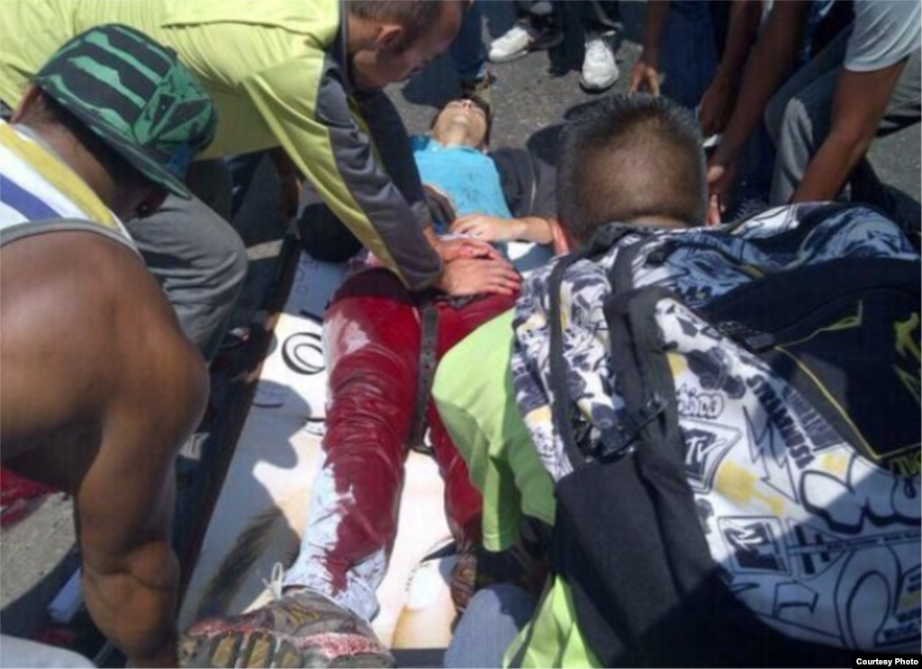 José Día, profesor de inglés del IUTEPI, Valencia, herido gravemente