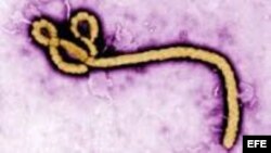 Imagen del virus del ébola.