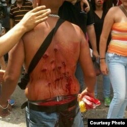 Las fuerzas represivas utilizan perdigones para castigar a los manifestantes. Geraldine Moreno murió de un escopetazo en el rostro.
