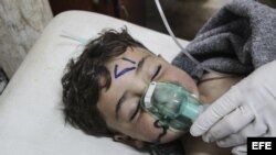 Un niño recibe tratamiento médico tras un supuesto ataque químico contra la localidad de Jan Shijún. 