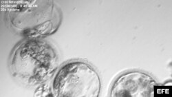  Fotografía cedida por la Universidad Oregon Health & Science que muestra temprana etapa de blastocistos embriones humanos que se desarrollan a partir de células de piel humana.