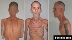 Alexander Díaz Rodríguez, exprisionero político cubano.