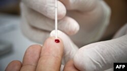 Especialista practica test rápido para detectar VIH