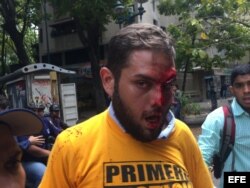 El diputado del partido opositor Primero Justicia, Juan Requesens, resultó herido en la cabeza por presuntas personas armadas.