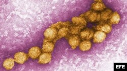 Un micrográfico electrónico del virus del Nilo (Centro para el Control de Enfermedades)