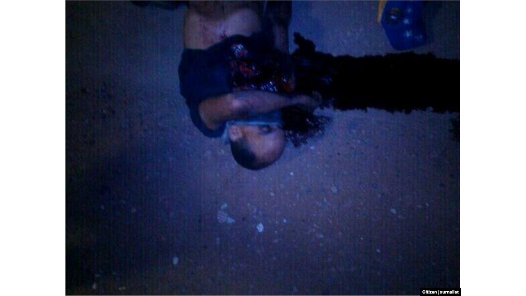 El estudiante Roberto Anesse, en un charco de sangre tras ser baleado por paramilitares en El Naranjal, Maracaibo