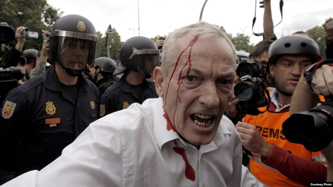 Uno de los heridos en la carga policial ocurrida esta tarde en la plaza de Neptuno cuando varios jóvenes de la protesta del 25S intentaron traspasar la valla que protege el acceso al Congreso de los Diputados.