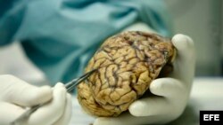 La donación de cerebros, tanto enfermos como sanos, es imprescindible para avanzar en la comprensión del Alzheimer.