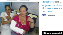 Reporta Cuba. Mujeres víctimas de la violencia. Foto: José Daniel Ferrer.