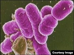 La bacteria se propaga fácil por alimentos y aguas contaminados.