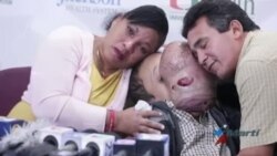 Doctor Marx celebra el valor de fallecido adolescente cubano con tumor en el rostro
