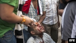 Enfrentamientos en El Cairo, Egipto. 