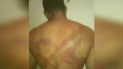 Juicio en Bahamas abre heridas en cubanos maltratados