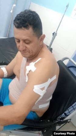 Gámez Alaníz recibió varios impactos de bala de parte de sus agresores, los que, asegura, fueron contratados por el régimen de Daniel Ortega.