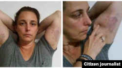 Reporta Cuba. Tania Bruguera, víctima de la represión castrista, 7 de junio. Foto: Ailer González.
