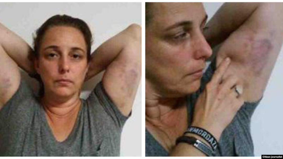 Reporta Cuba. Tania Bruguera, víctima de la represión castrista, 7 de junio. Foto: Ailer González.