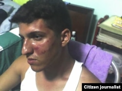 Ridel Brea agredido por militares Santiago de Cuba agosto 24