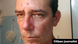 Reporta Cuba. Lázaro Yuri Valle, reportero ciudadano maltratado por oficiales de la Seguridad del Estado.