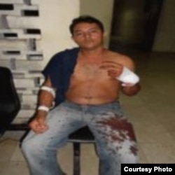 Activista Werlando Leyva agredido a machetazos en Holguín
