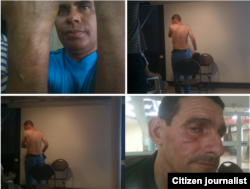 Reporta Cuba. Arturo Rojas (i) muestra huellas de esposas. Mario A. Hernández (d) muestra huellas de los golpes.