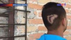 Periodista independiente cubano agredido por su vecino