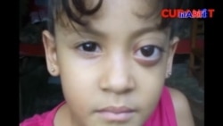 Oftalmólogos cubanos dicen no estar preparados para atender a esta pequeña