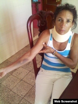 Leticia Ramos Dama de Blanco muestras golpes propinados por policias al ser detenida a la salida de la iglesia en Cárdenas Matanzas