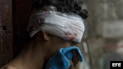 Vista de un joven herido en la cabeza tras ser agredido durante una acción policial en el barrio María Auxiliadora de Managua.