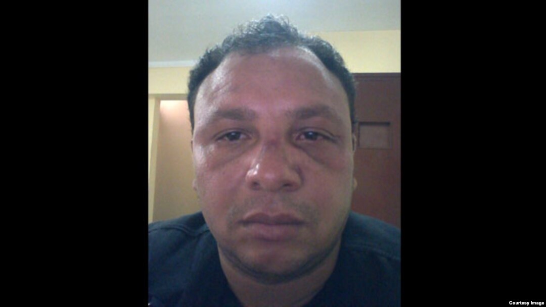 El periodista independiente Roberto de Jesús es golpeado en La Habana