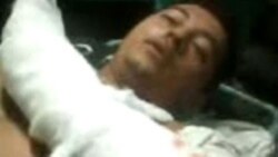 Sale del hospital activista del MCL que fue herido con un machete