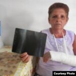 Dama de Blanco Sonia Alvarez agredida en julio 21 Colón twitpic de @SayliNavarro