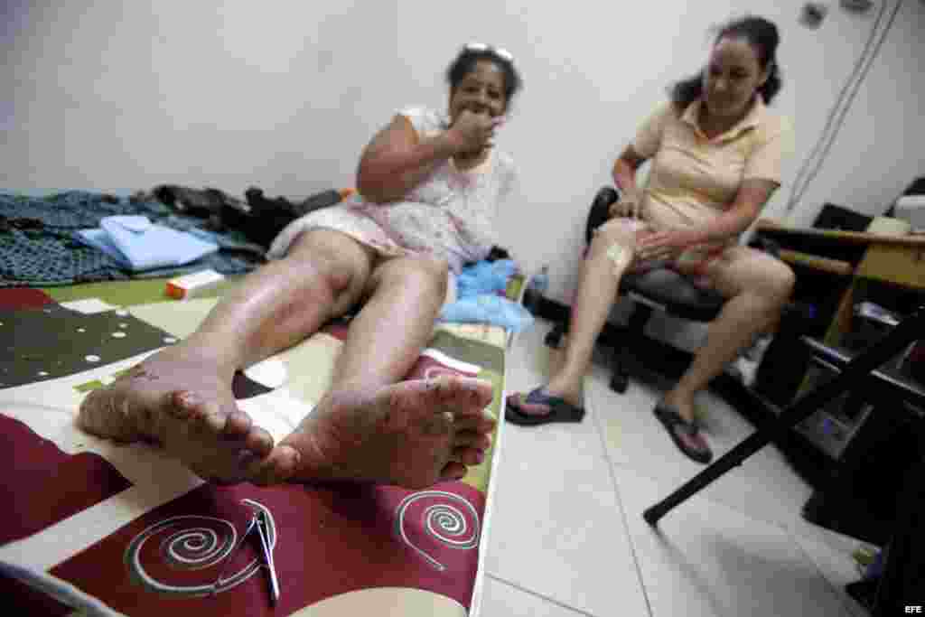 Una mujer cubana con excoriaciones en sus pies tras marchar 10 días por la selva del Darién, zona fronteriza con Colombia, permanece el 29 de agosto de 2016, en la sede de la Pastoral Social Cáritas en Ciudad de Panamá (Panamá).