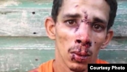 Joven golpeado por la policía en Santiago de Cuba.
