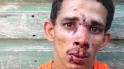 Ataques contra viviendas de opositores pacíficos en Cuba