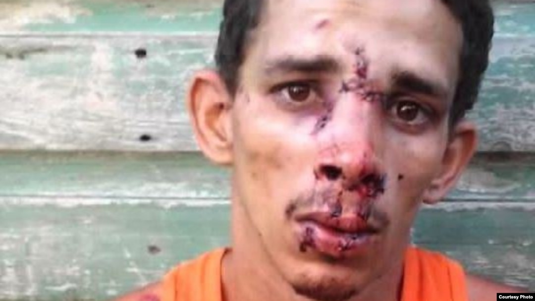Joven golpeado por la policía en Santiago de Cuba.