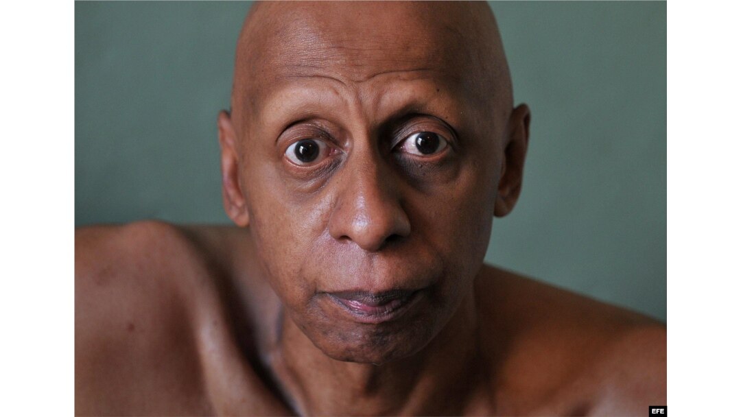 El disidente cubano Guillermo Fariñas, premio Sájarov 2010 a la libertad de conciencia