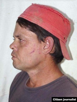 Reporta Cuba Leonel Freeman golpeado cuando acompañaba a su hermano que es activista de DDHH.